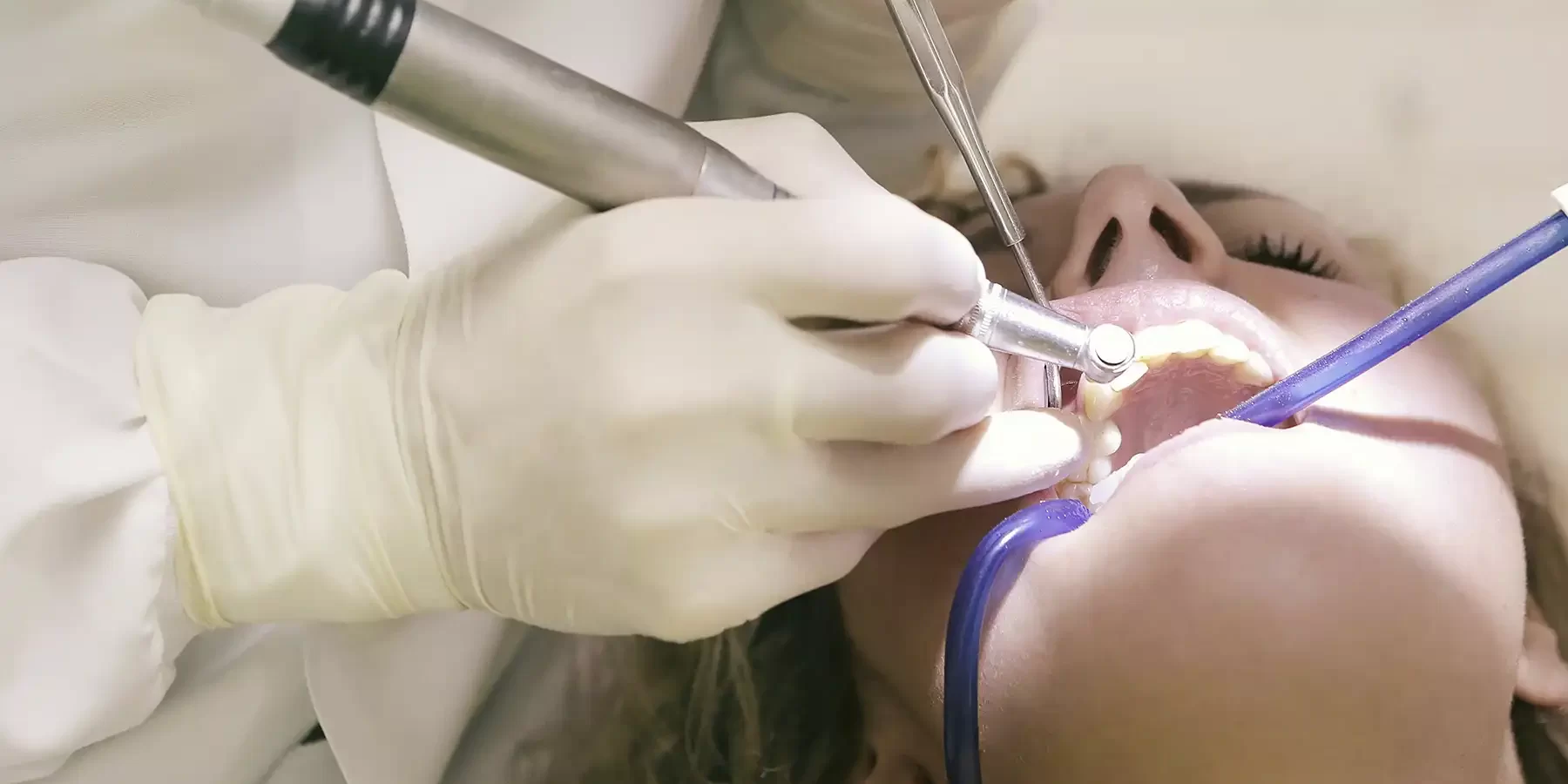 Ortodoncista realizando revisión inicial tras 3 semanas de haber colocado los brackets