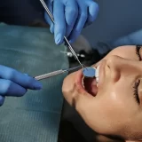 Paciente con boca abierta mostrando brackets linguales colocados una opción estética al pensar qué tipo de brackets es mejor para ti