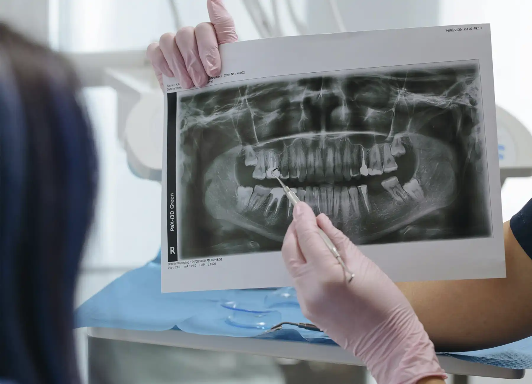 Radiografía panorámica utilizada para diagnosticar cómo saber si necesito ortodoncia