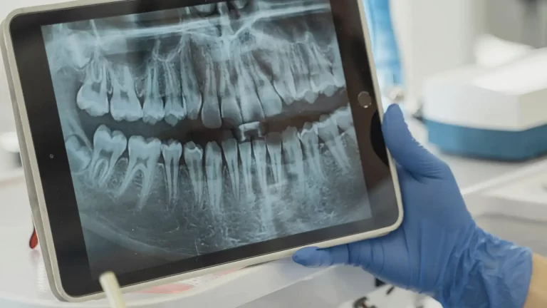 diagnostico-profesional-de-apinamiento-dental-con-escaner-3d