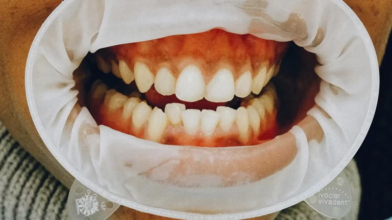 ortodoncista-evaluando-sonrisa-con-dientes-salidos-en-corregidora