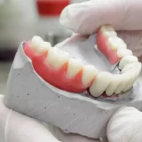 rehabilitacion prostetica dental para pacientes en corregidora queretaro